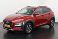 Hyundai KONA 1.6 GDI HEV Fashion